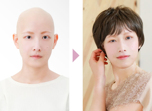 ウィッグビフォーアフター