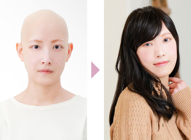 ビフォーアフターでわかる、自然な変化