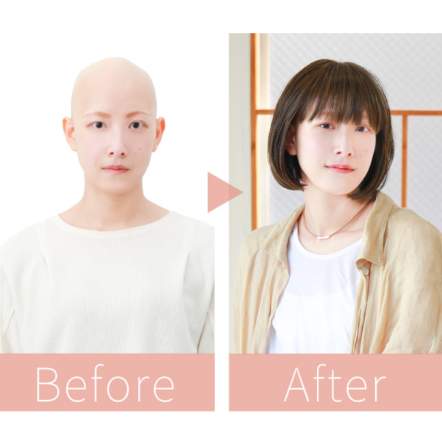 医療用ウィッグ装着後